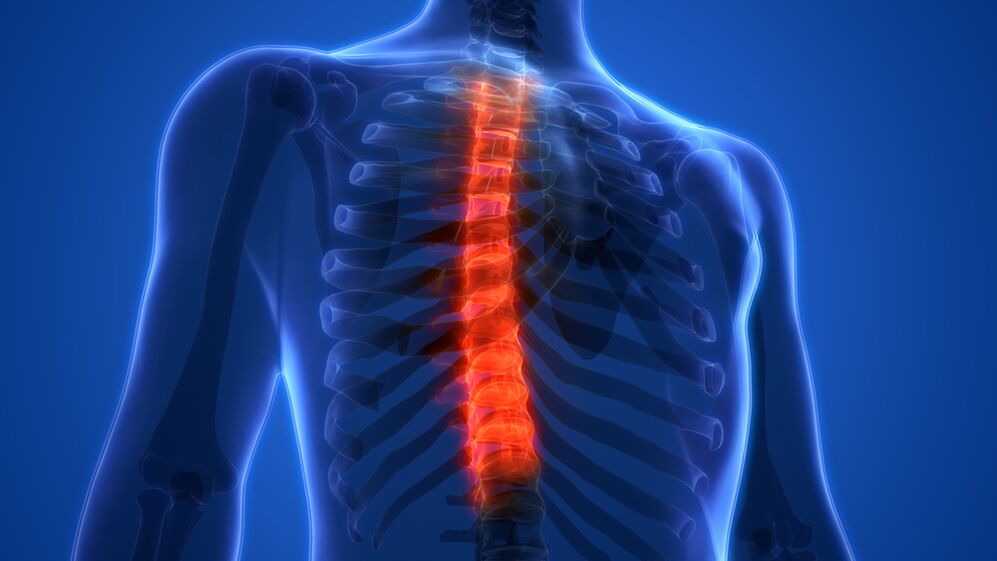 osteocondrose da columna vertebral torácica